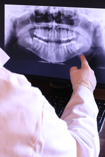 Best Emergency Treatment for Dental Infections or Abscesses in Sesser, IL