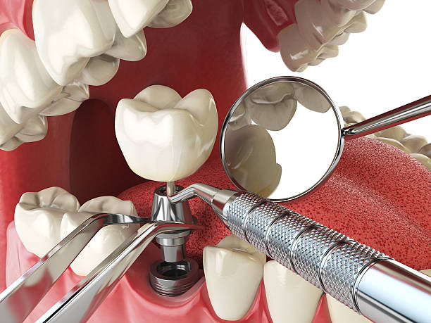 Best Cosmetic Emergency Dentistry in Sesser, IL